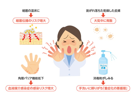 手荒れ重症化が引き起こす問題