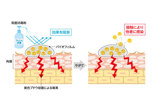 肌の傷に吸着した黄色ブドウ球菌が形成するバイオフィルム