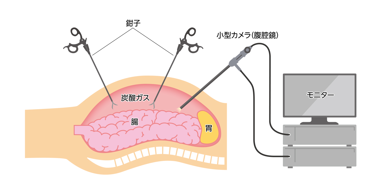 消化器外科手術 下部消化管 ~イラストと動画で達人の手技を身に